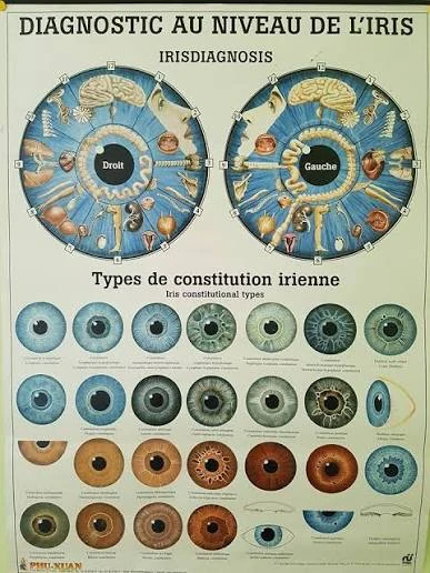 Planche ancienne de cartographie de l'iris et types de constitution irienne